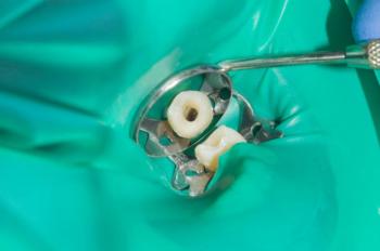 Endodontia RisusClinic