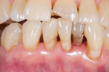 Periodontologia RisusClinic