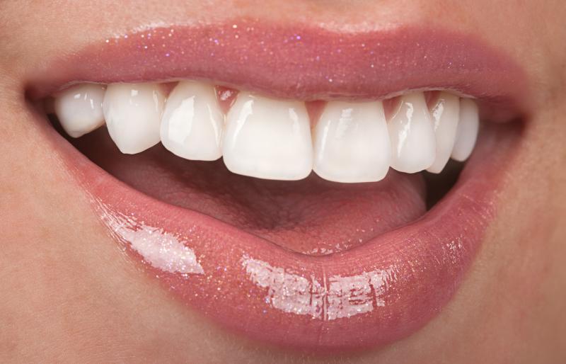 Facetas RisusClinic