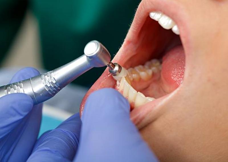 Higiene e Saúde Oral RisusClinic