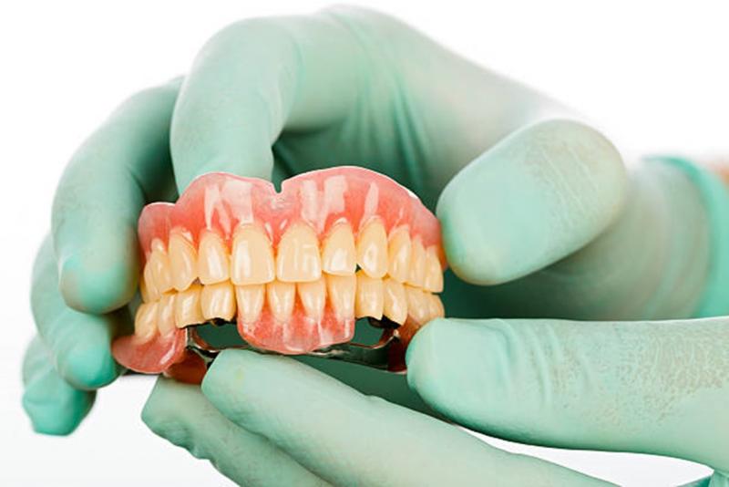 Prótese Removível RisusClinic